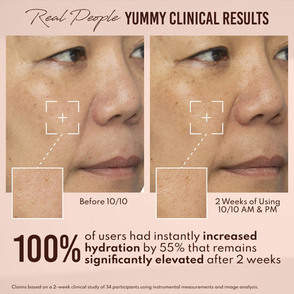Yummy Skin 10/10 Barrier Boost Hyaluronic Acid + Ectoin Plumping Serum